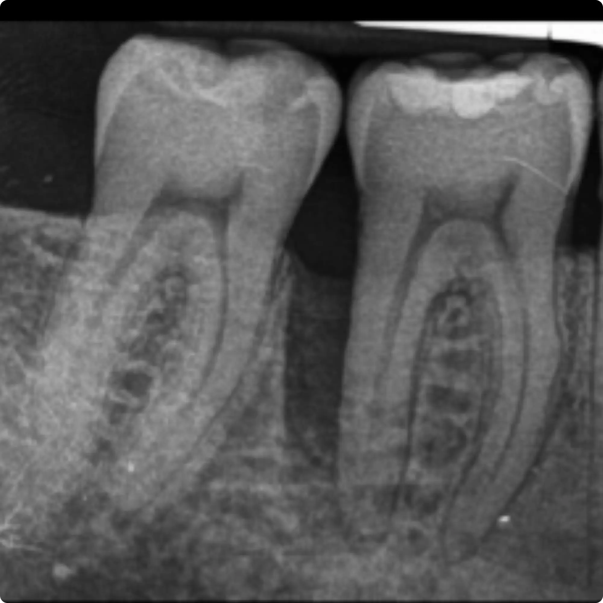 Case 1 Baseline