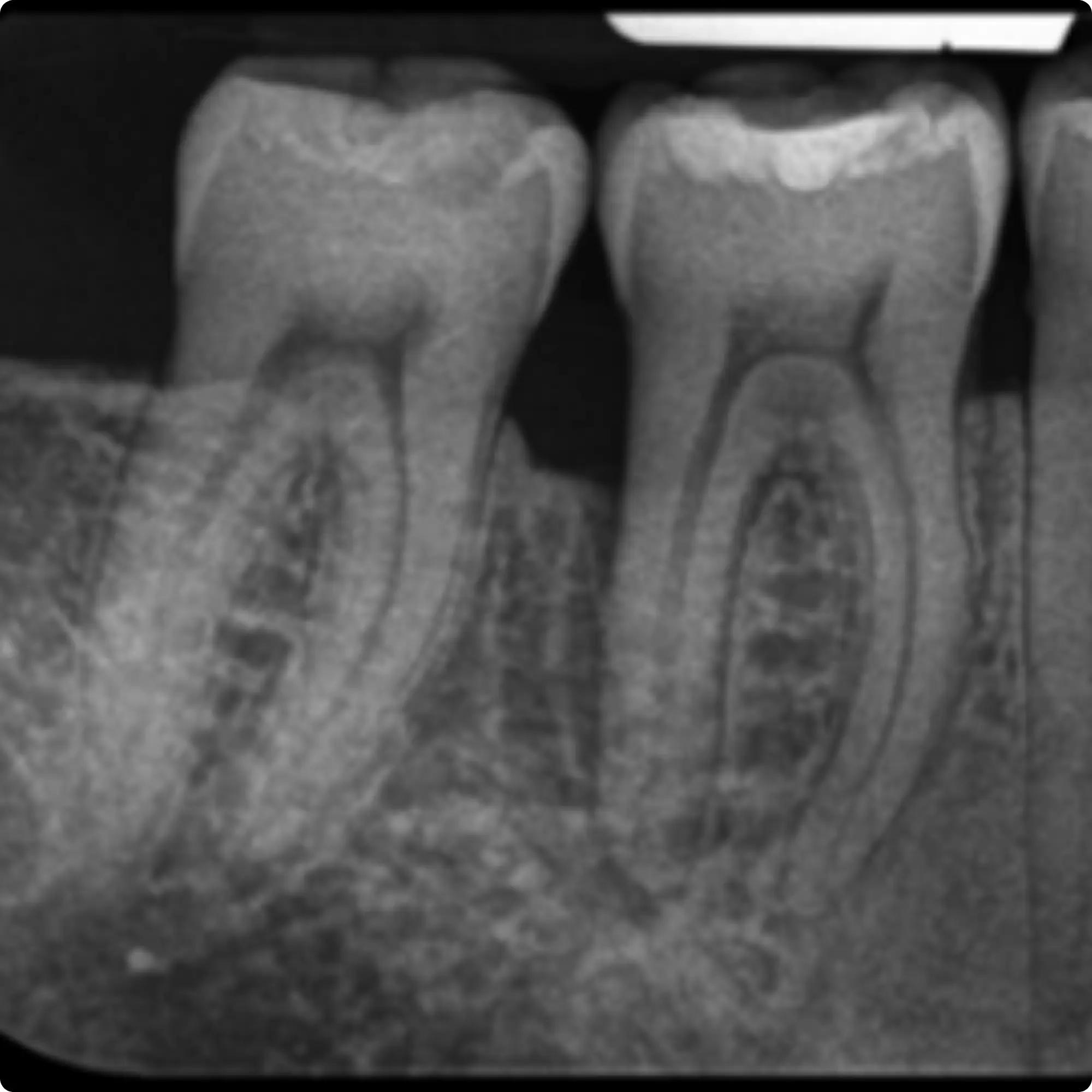 Case 1 One Year