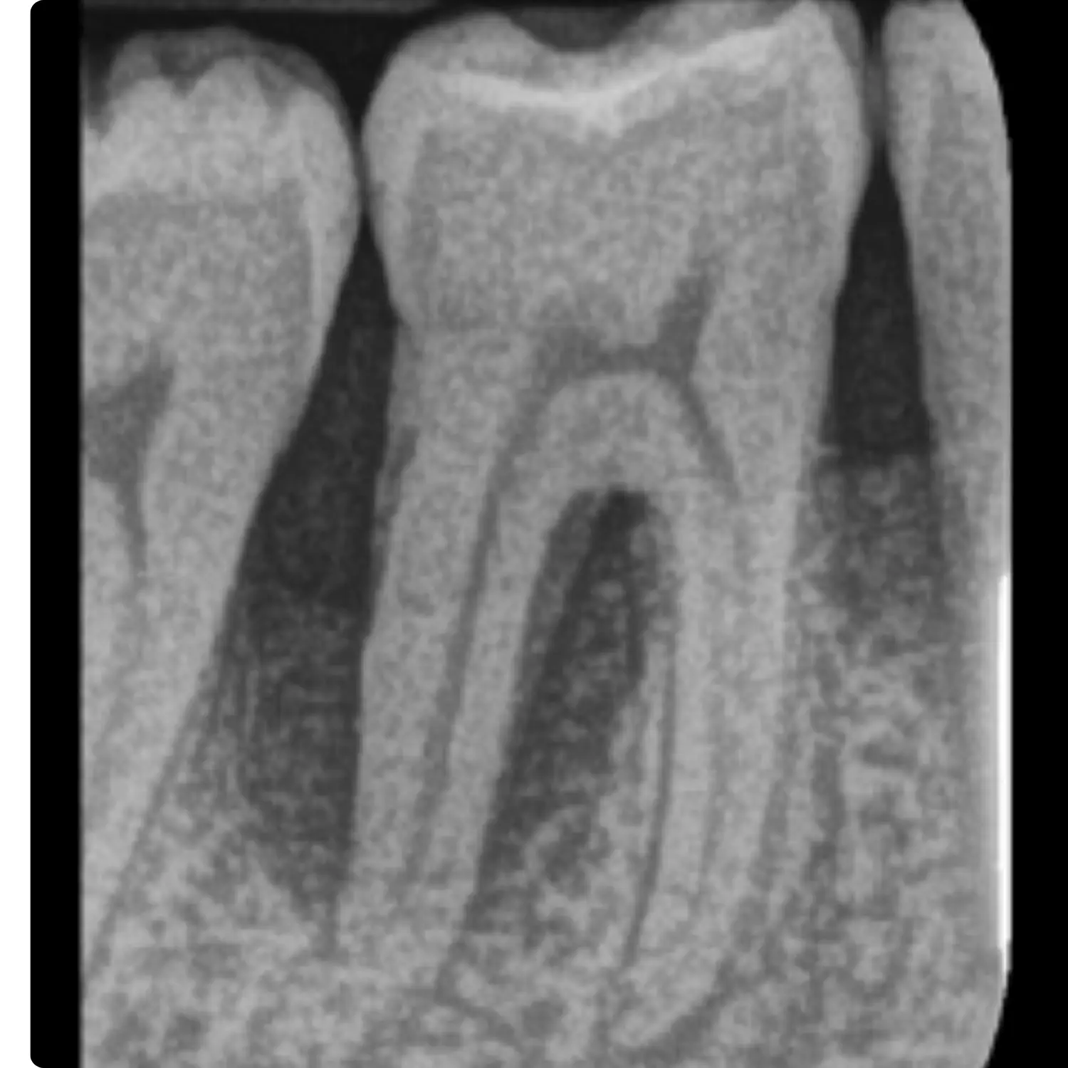 Case 2 Baseline