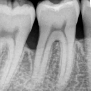 Case 2 Eight Years